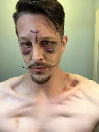 This dude got jumped by 6 guys