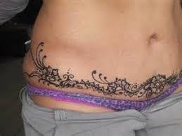 Images Search Yahoo Com Images View Ylt Awrb8pmwetdxbeua4thgnilq Ylu X3odmtiyoduynxa3bhnlyw Tatuaje En Cicatriz Tatuaje Para Tapar Cicatriz Tatuaje De Encaje