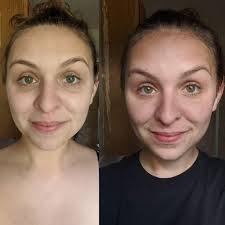 Looking for a cleanser and moisturiser for dry skin that is prone to  hormone break outs. I don't mind spending a few dollars