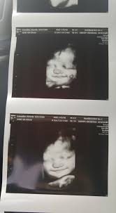 Your baby's brain can now control its body temperature. How Much Does Your Baby Weigh And At How Many Weeks Glow Community