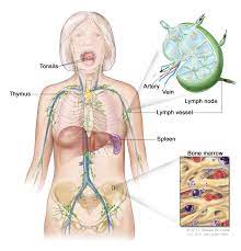 Stage four pancreatic cancer means the cancer has spread to other sites—it may or may not be in nearby lymph nodes. Lymphedema Pdq Patient Version National Cancer Institute