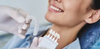 Step By Step Guide for Invisalign Treatment