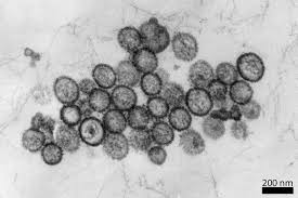 Das hantavirus ist weltweit gefürchtet. Hantavirus In Deutschland 2019 Ist Ganz Deutlich Ein Ausbruchsjahr Express De