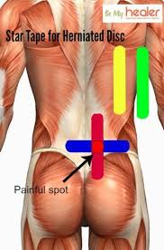 Pin On Back Pain