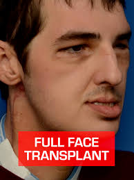 Bp Whiting Crane Accident