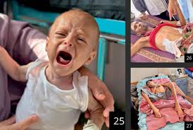 Starvation Is Everywhere': Virtual Tours of Gaza Clinics Expose Scale of  Horror