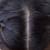 Female Thinning Hair