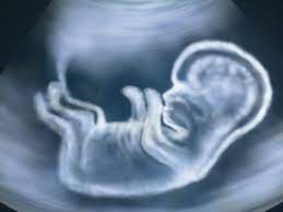 Are Ultrasounds Safe For The Mother Baby Alike 3d 4d Ultrasound Studio Queens