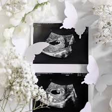 Know that pregnancy is possible again: 5 Women Share What It S Like To Have A Miscarriage Gma