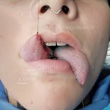 Tongue splitting, agendando Santiago info al dm #tonguesplitting  #bifurcacion #lengua #tonguesplit #tongue #modificacioncorporal  #bodymodification #bodymod #bmod