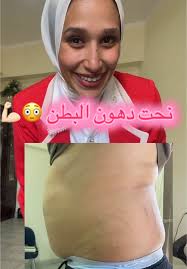 سحر الميزوثيرابي لرحلة تغيير الجسم