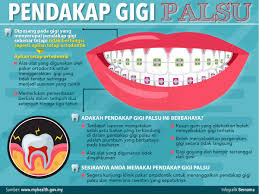 Alat sebegini boleh ditanggalkan, namun terdapat juga reka bentuk yang membolehkan ia melekat pada rongga mulut secara kekal (implan gigi). Bernama On Twitter Infografik Adakah Anda Sedar Bahaya Pendakap Gigi Palsu
