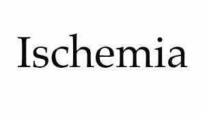 Listen to the audio pronunciation in the cambridge english dictionary. How To Pronounce Ischemia Youtube