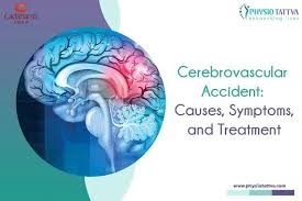 Image result for CVA Management