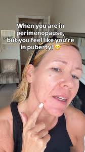 At 49 I feel like in puberty! Anyone else experiencing this? I have deep  inflamed cystic acne breakouts! 🫣 #perimenopause