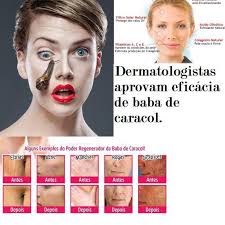 Baba de Caracol Original