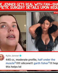 Kylie Jenner Discusses Cosmetic Surgery Insights