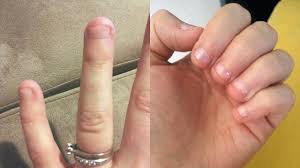 How to easily remove acrylic nails at home. Can T Stop Biting Your Nails Try Getting Them Shellacked