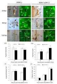 Maybe you would like to learn more about one of these? Tadir1 2 A Wheat Ortholog Of Lipid Transfer Protein Atdir1 Contributes To Negative Regulation Of Wheat Resistance Against I Puccinia Striiformis I F Sp I Tritici I Abstract Europe Pmc