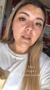 Comenzando la etapa de picados! #bariatrica #salud #mangagastrica #fyp  #chile #greenscreen #viral #glowup #temuco