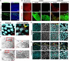 Check spelling or type a new query. An Absence Of Lamin B1 In Migrating Neurons Causes Nuclear Membrane Ruptures And Cell Death Pnas