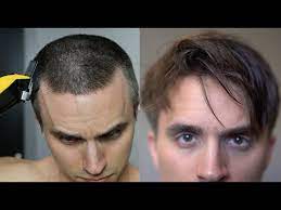 For the long buzz cut, you can keep your hair as long as three inches. Growing Out My Hair From A Buzzcut 8 Months After Hairstyle Update Youtube