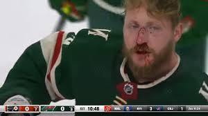 Why Is Fighting Allowed In The NHL? It's Complicated