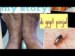 Cara menghilangkan kutu kucing yang cukup ampuh untuk mengusir kutu maupun telur kutu dari badan kucing yaitu dengan memandikannya menggunakan sampo khusus. Vampir Lompat Gigitan Pinjal Kutu Lompat Kutu Kucing Story Waktu Pinjal Invansi Di Rumah Youtube