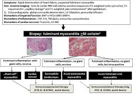 Myocarditis treatment focuses on the cause and the symptoms, such as heart failure. Management Of Fulminant Myocarditis A Diagnosis In Search Of Its Etiology But With Therapeutic Options Springerlink