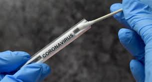 Fill out the nys contact tracing tool. 14 09 2020 Covid 19 Only Get A Test If You Have Symptoms Of The Virus