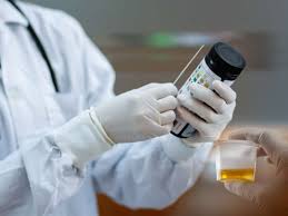 urine ph normal ranges and what they mean