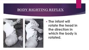 Primitive Reflexes And Postural Reactions Free Trial - Pass The Ot