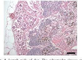 The diagnosis of mesothelioma should be considered in any patient with a unilateral pleural effusion or thickening, especially if chest pain . Pdf Pericardial Mesothelioma In A Dog With Lymph Node Metastasis And Chylothorax Semantic Scholar