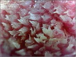 Tiny bumps called papillae give the tongue its rough texture. Microbes Of The Human Tongue Form Organized Clusters The Scientist Magazine
