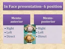 Image result for Shoulder Presentation