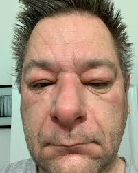 REP will soon R.I.P. The end does not justify the means. It is segregation,  and discrimination, it will tear people apart, and turn friend, families  and neighbours