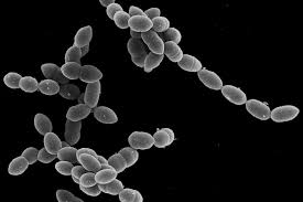 Image result for Influenza