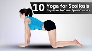 This is part 2 of a two part yoga for scoliosis series. Yoga For Scoliosis 10 Yoga Poses To Correct Spinal Curvature