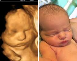 1 free recheck if your baby does not cooperate. Home