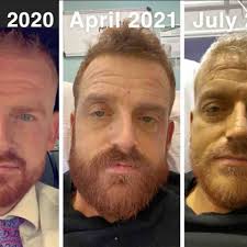 Fundraiser by Maria Galbraith : Help Anthony Galbraith with private  treatment