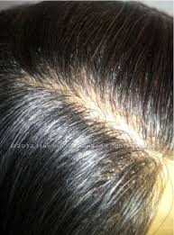 Best natural looking wigs for caucasian. Real Natural Looking Wigs Pasteurinstituteindia Com
