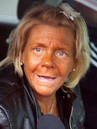 Patricia Krentcil, Tanning Mom, Banned from Salons