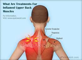 The back contains the spinal cord and spinal column, as well as three different muscle groups. Inflamed Upper Back Muscles Treatment Causes Symptoms