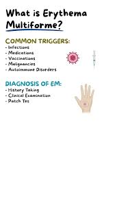 Image result for Erythema Multiforme Causes