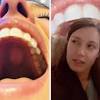 Developing a bump on the roof of mouth is a problem that at least a large number of people have experienced. Https Encrypted Tbn0 Gstatic Com Images Q Tbn And9gct8qvclccuktdlhoqjhusyuckwdfxn Euzcicilrsh7 Us5xibr Usqp Cau