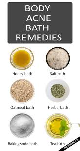 Body Acne Remedies With Bath Recipes Naturalacneremedies Natural Acne Remedies Body Acne Remedies Bath Recipes