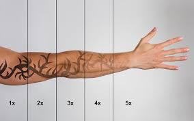 Where can i find tattoo removal deals near me? Adept Tattoo Removal Cost For Small Tattoo Removal Cost Toronto