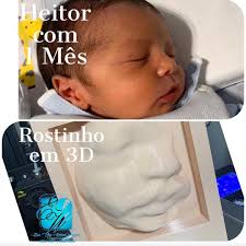 ✨ Das imagens em preto e branco… ao rostinho em suas mãos. Os diagnósticos  e as medidas sempre serão feitos pelas imagens tradicionais, as preto e  branco, que consegue acompanhar o crescimento