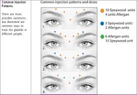 Top 3 Botox Injection Patterns Markup Skinviva Training