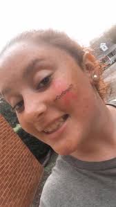 DeAnna's Breast Cancer Support